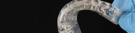¿Qué es el guarda oclusal?