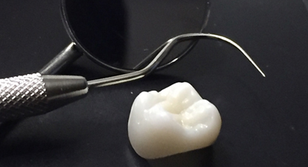 Corona Dental