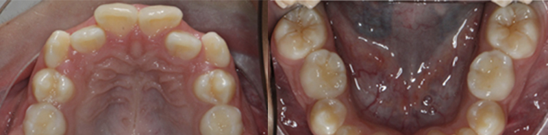 <p>¿Cuándo referir un paciente al Ortodoncista?</p>